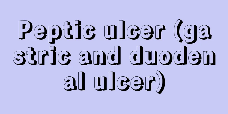 Peptic ulcer (gastric and duodenal ulcer)