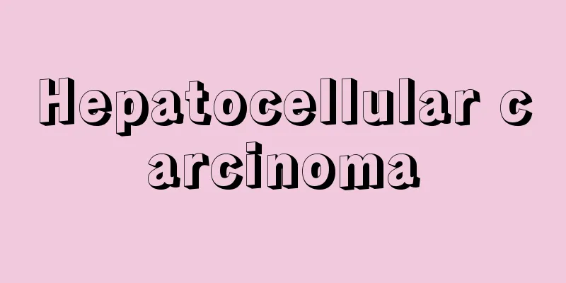 Hepatocellular carcinoma